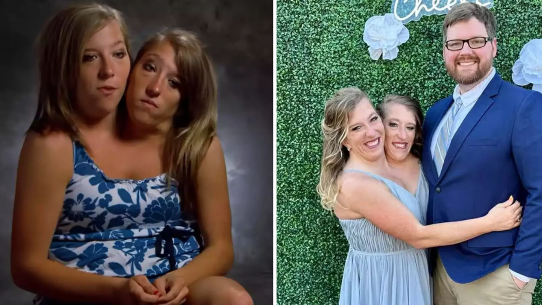 Abby and Brittany Hensel